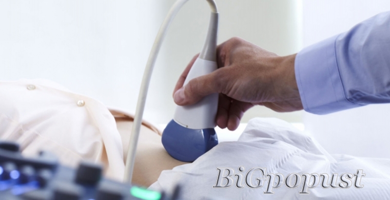 2500 rsd ultrazvučni pregled kompletnog abdomena + GRATIS kompletna krvna slika, leukocitarna formula 